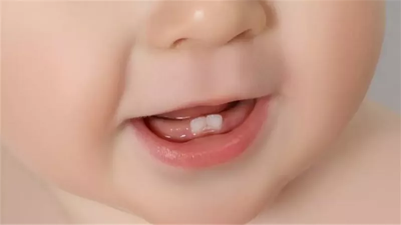  أبرز علامات تسنين الأطفال وطرق التخفيف منها بأمان 