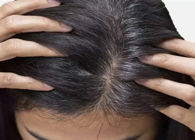 وصفة طبيعية للتخلص من الخصل البيضاء بدون صبغة 